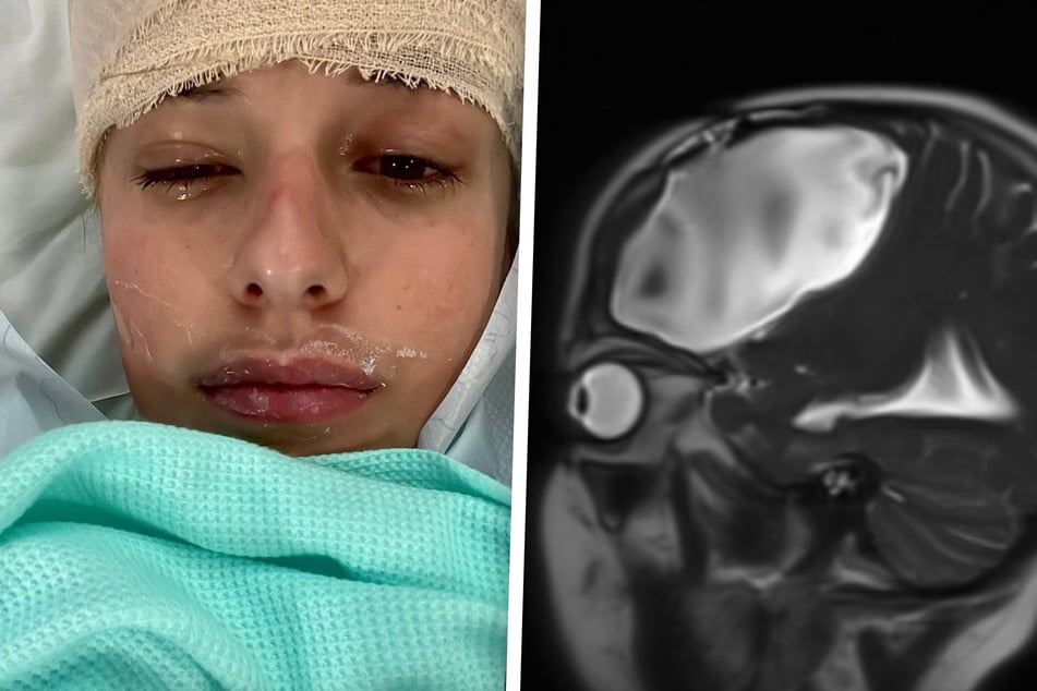 2025 schien die Britin bereits auf einem guten gesundheitlichen Weg zu sein. Doch der Tumor wuchs immer wieder nach.