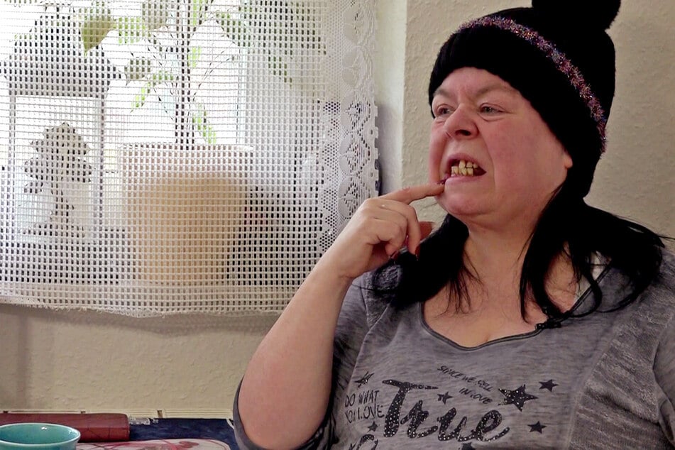 Pamela (58) hat Probleme mit ihren Zähnen.