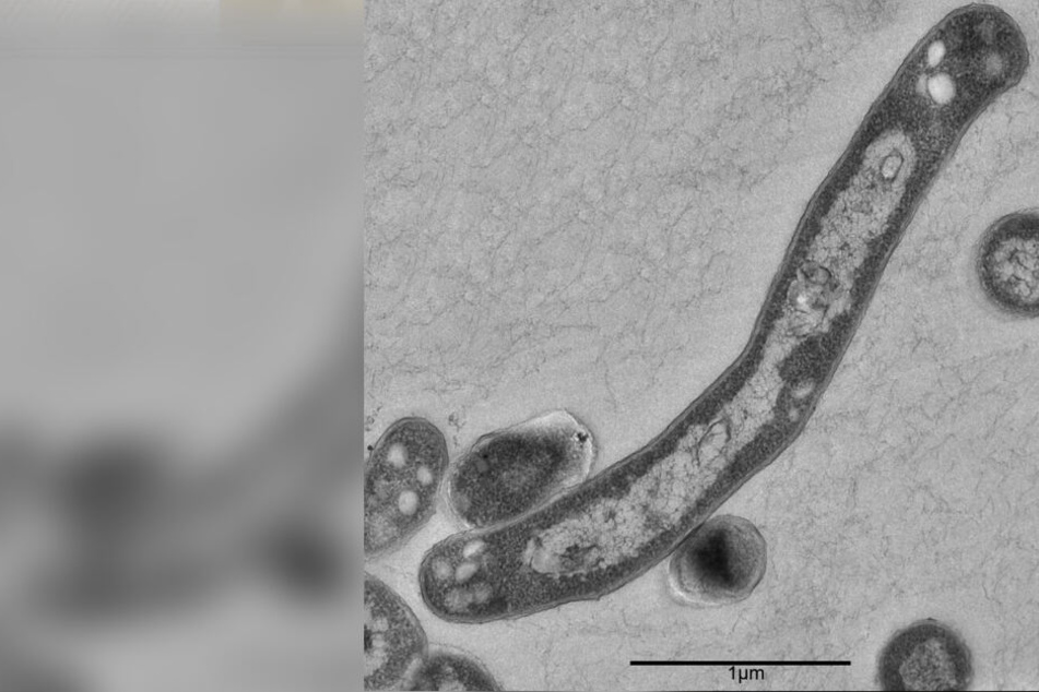 Tuberkulose kann durch Niesen oder Husten übertragen werden.