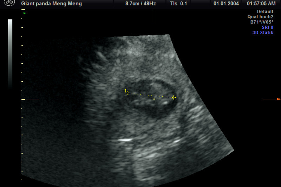 Auf dem Ultraschallbild von Panda-Dame Meng Meng ist zu erkennen, dass sie mit Zwillingen schwanger ist.