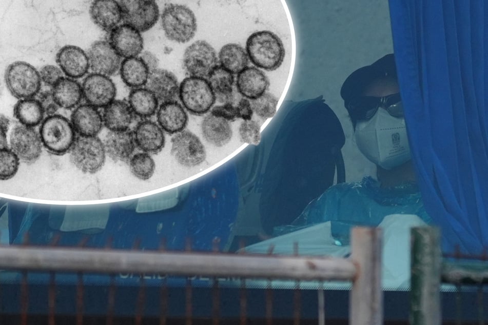 Nach Kreuzfahrt: Hantavirus-Patientin an künstliche Lunge angeschlossen