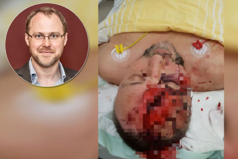 Kommentar zum attackierten AfD-Politiker: Es gibt keinen "guten" Hass!