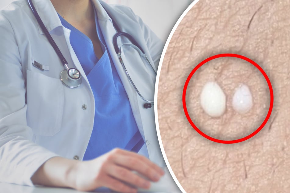 Después del nacimiento de su hijo: la mujer “suda” leche por las axilas