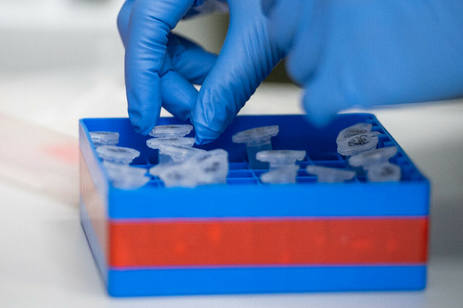 Eine Laborantin sortiert im Institut für Virologie an der Charite Berlin Mitte, in dem Untersuchungen zum Coronavirus laufen, Proben.