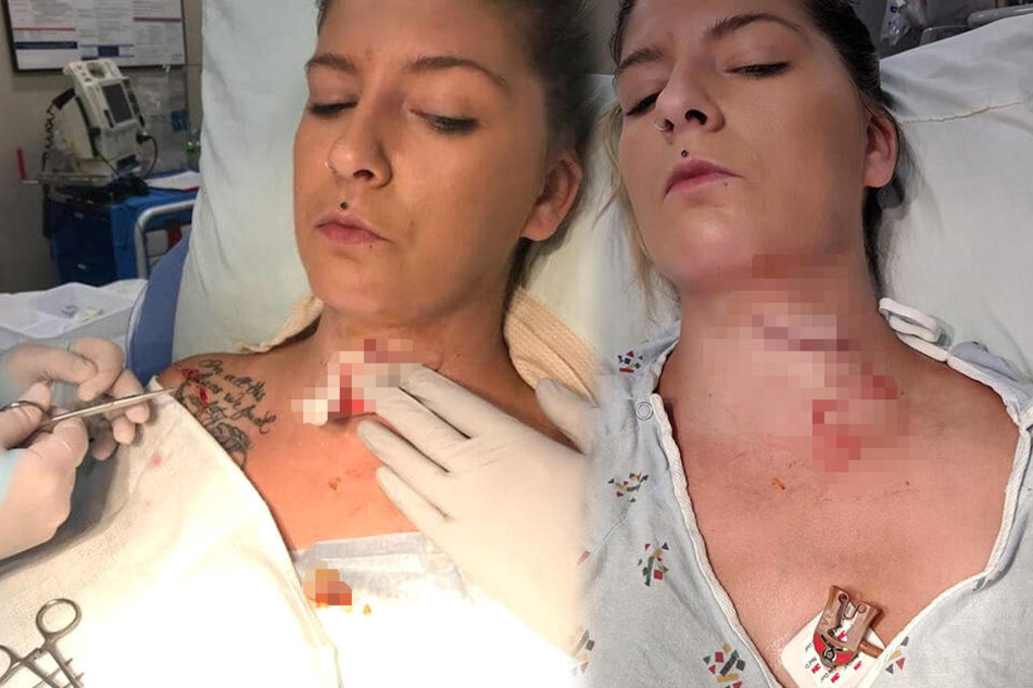 Kendra Jensen (28) hätte es noch viel schwerer erwischen können.