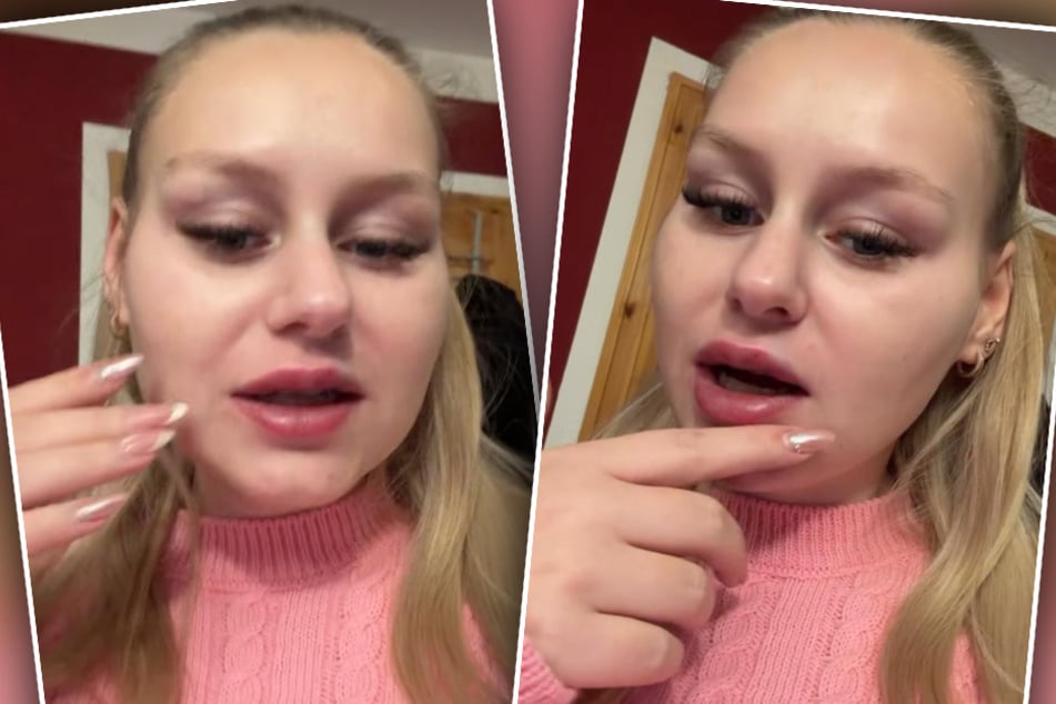 Sarah-Jane (27) zeigte ihren Fans bei Instagram das vorläufige Ergebnis ihrer Lippenaufspritzung.