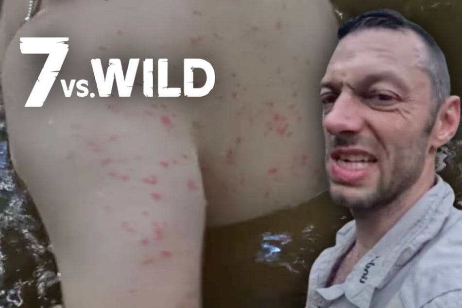 Larven dringen in Haut ein: Werden "7 vs. Wild"-Teilnehmer von Parasiten geplagt?