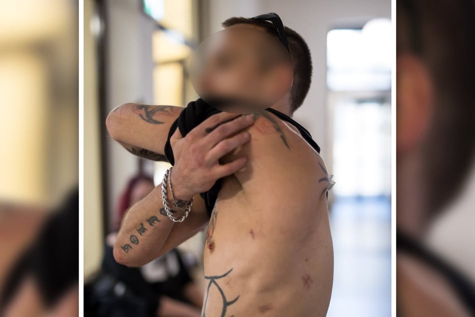 Wurde wegen seines Hustens attackiert: David K. (42) - die Einstiche in seinen Oberkörper sind auch fünf Monate später noch zu sehen.