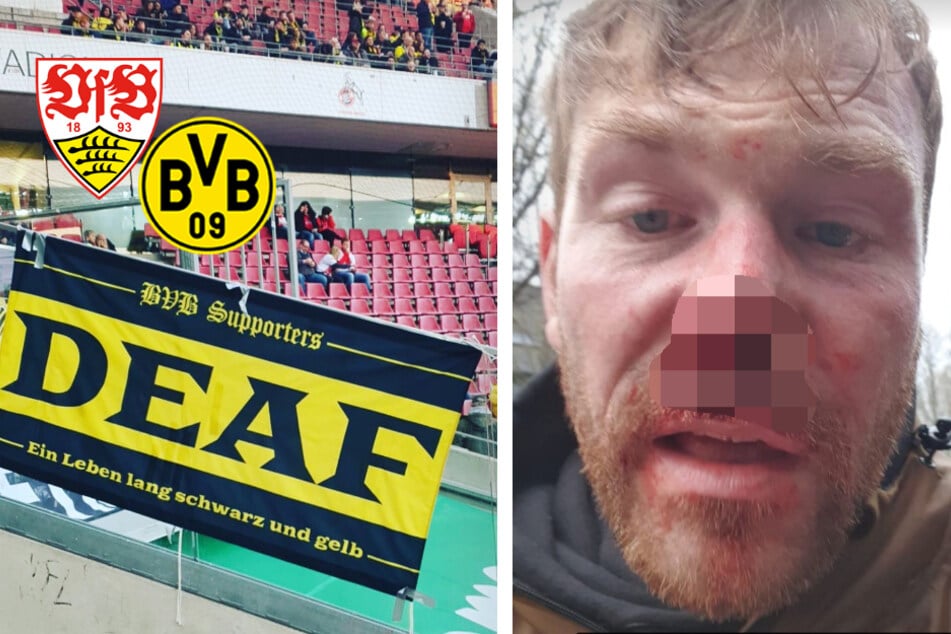Prügel-Attacke bei VfB-Kick: BVB-Fan erstattet Anzeige