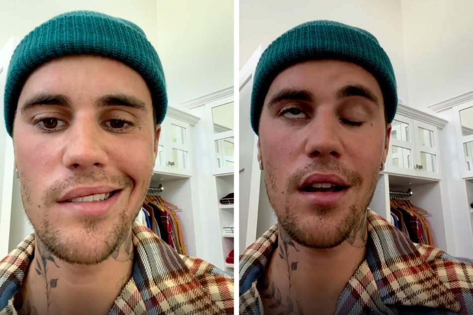 Die seltene Virus-Erkrankung greift Justin Biebers (28) Nerven im Ohr und Gesicht an.
