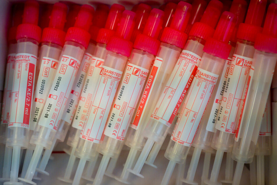 Jeder soll sich in Bayern auf das Corona-Virus testen lassen können - ganz unabhängig davon, ob er Symptome hat oder nicht.