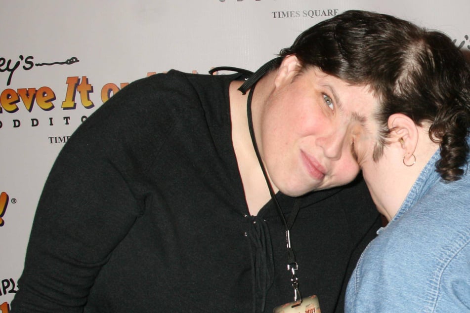 Älteste siamesische Zwillinge der Welt: Dieses Geheimnis behielt einer von ihnen jahrzehntelang für sich