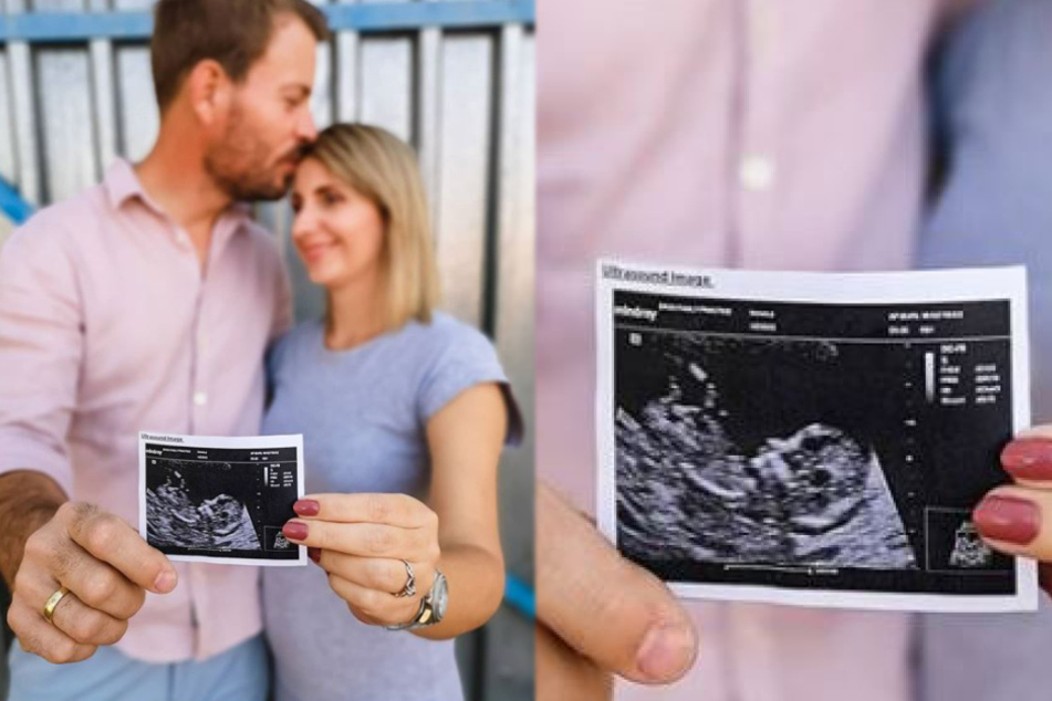 Anna und Gerald vor einer Woche auf Instagram mit einem ersten Ultraschallbild ihres Babys.