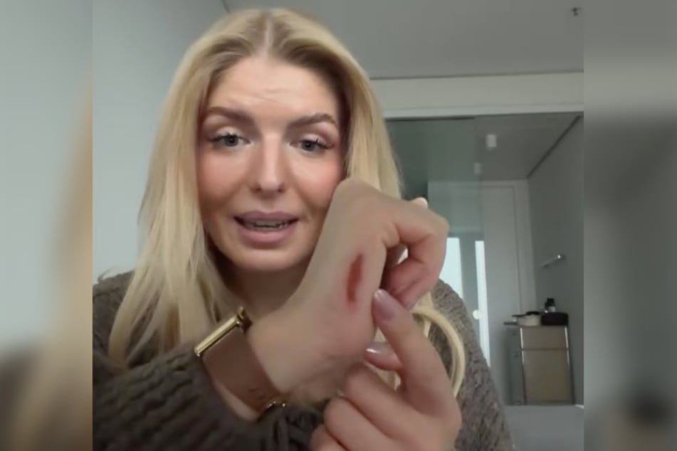 Nach Dreharbeiten in Brasilien hat Antonia Hemmer (25) mit gesundheitlichen Problemen zu kämpfen - unter anderem mit heftigem Juckreiz.