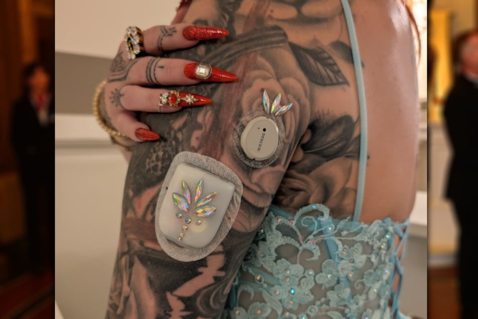 Passend dazu hatte die Diabetes-Influencerin ihre Insulinpumpe sowie ihren Glucosesensor mit Glitzer versehen. Beides trug sie diesmal offen, statt sie zu verstecken.