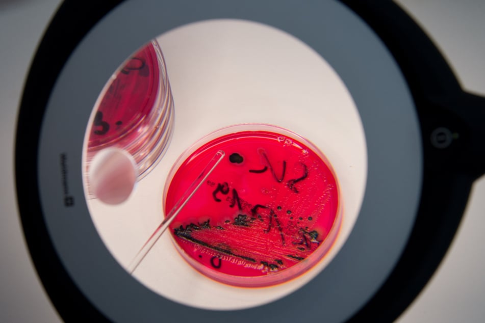 Salmonellen in einer Petrischale: Die stäbchenförmigen Bakterien können Krankheiten verursachen.