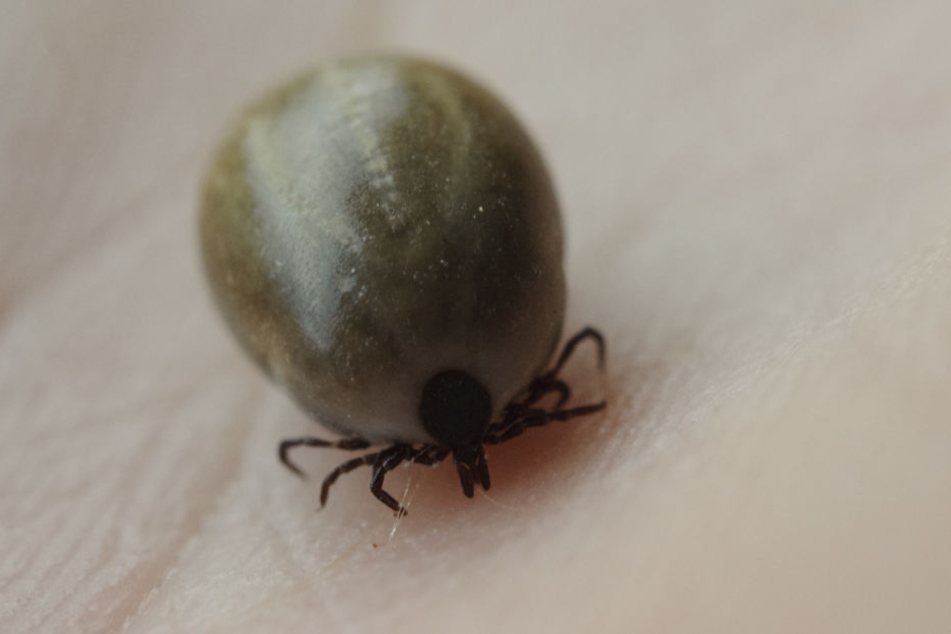 Eine mit Blut vollgesaugte Zecke auf menschlicher Haut: Auch 2018 wird es wieder viele Borreliose-Fälle durch Zeckenbisse geben.