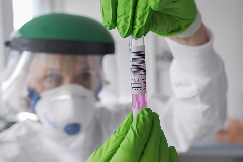 Eine wissenschaftliche Mitarbeiterin des Landesamts für Verbraucherschutz und Lebensmittelsicherheit (LAVES) hält eine Coronavirus-Testprobe in den Händen.