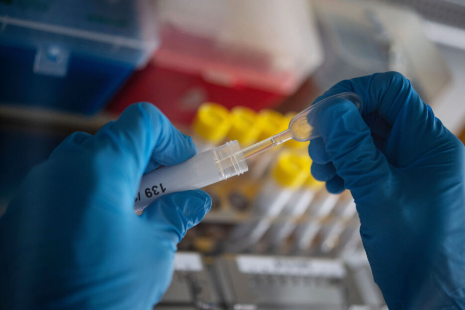 Forscher arbeiten daran einen Impfstoff gegen das Coronavirus zu entwickeln. (Symbolbild)