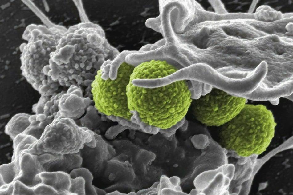 Methicillin-Resistant Staphylococcus aureus (MRSA) Bacteria Scanning electron micrograph of methicillin-resistant Staphylococcus aureus (MRSA) bacteria (colorized green) interacting with a human neutrophil.