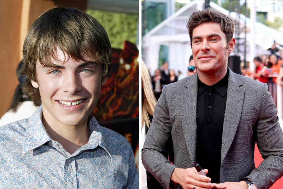 Fans spotted a noticeable difference in the look of Zac Efron's face from when he was younger (l.) and as he walked the red carpet at the Toronto International Film Festival on Tuesday.