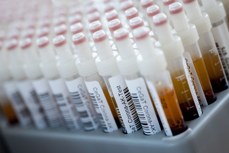 Blutentnahmeröhrchen mit Blutproben für einen Corona-Antikörper-Test stehen in einem Rack.