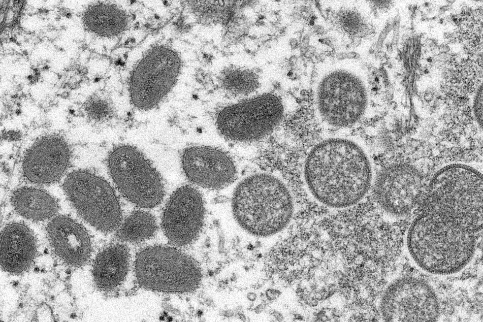 A microscopic view of the virus that causes monkeypox.