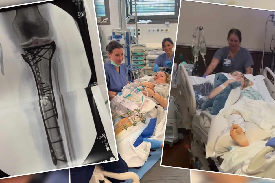 Schon fünfmal operiert: Lindsey Vonn verteidigt Olympia-Comeback und teilt gegen "Hater" aus