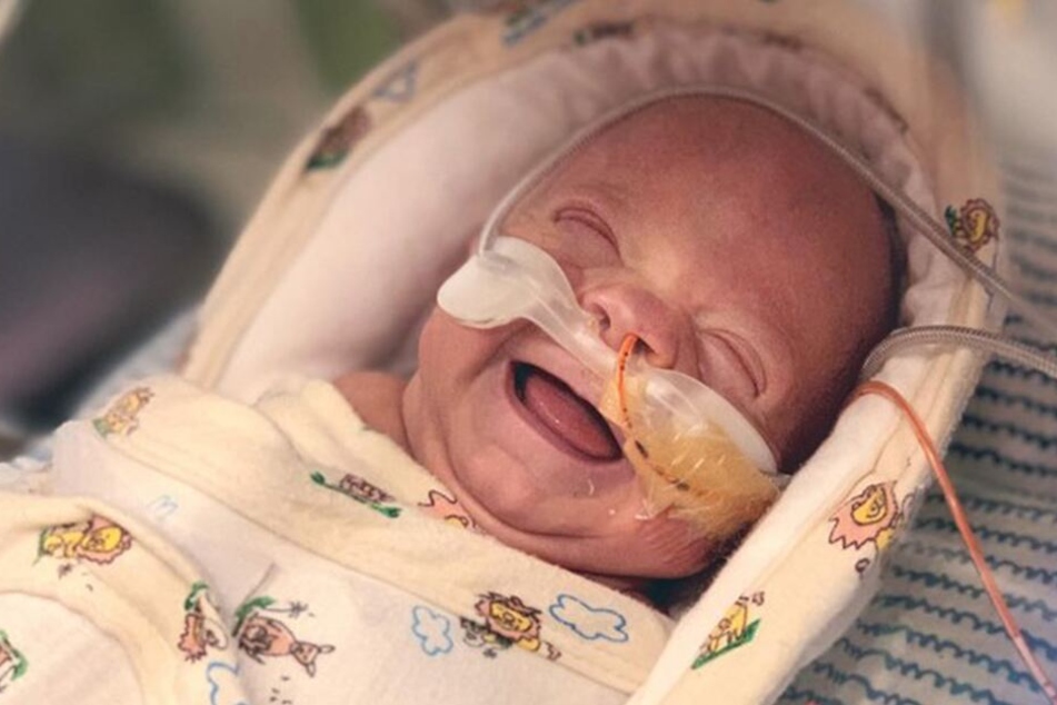 Ein Strahlemann! Finn wurde nach nur 24 Wochen geboren.