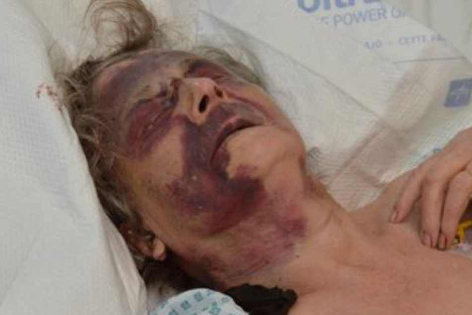 Iris Warner kämpfte im Krankenhaus um ihr Leben. Inzwischen geht es der 90 Jahre alten Frau etwas besser.