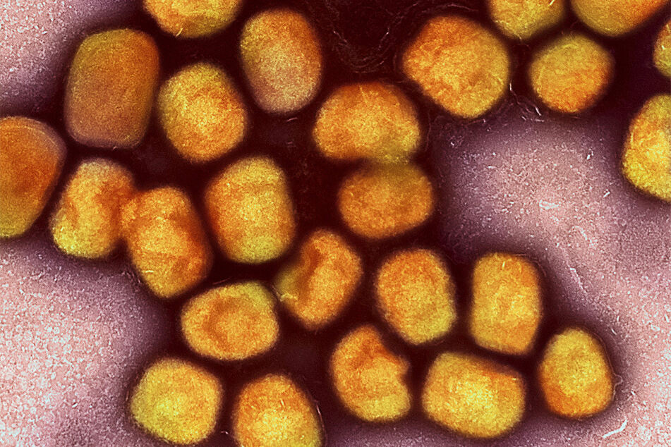 Nach mehr als einem halben Jahr ohne Nachweise von Mpox (früher Affenpocken) sind in Deutschland wieder einzelne Infektionen mit dem Virus bestätigt worden.