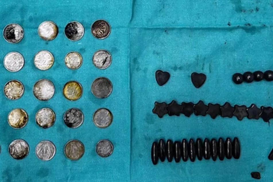 Die Ärzte holten funkelnde Münzen und Magneten in verschiedenen Formen aus dem Darm ihres Patienten.