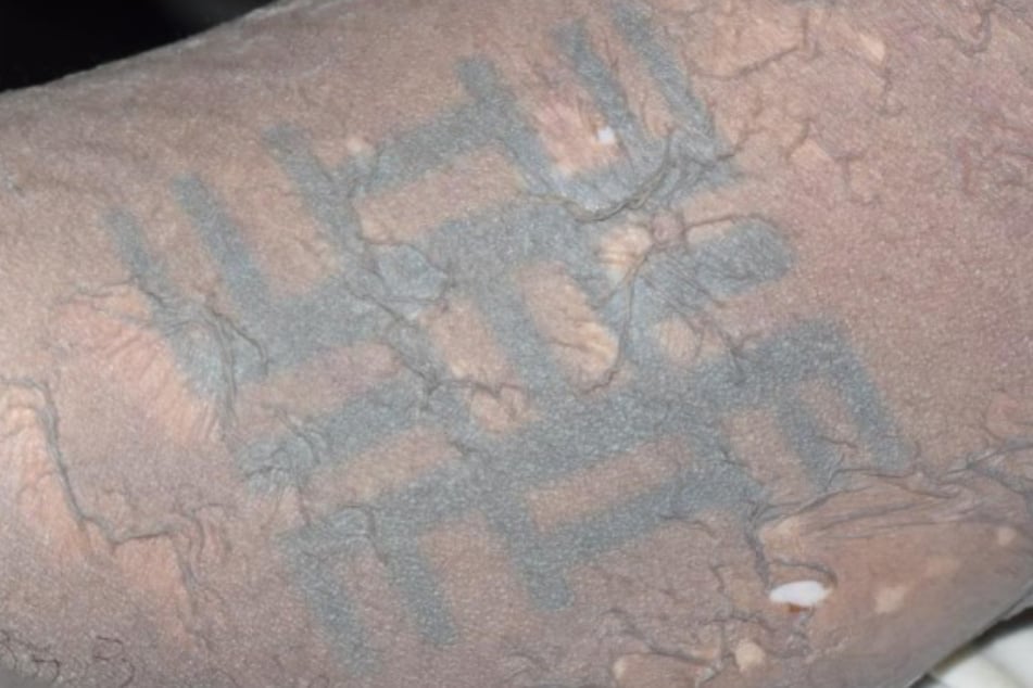 Der Tote hatte mehrere ungewöhnliche Tattoos, darunter dieses, dass die Polizei als "eine Art Käfer" identifizierte.
