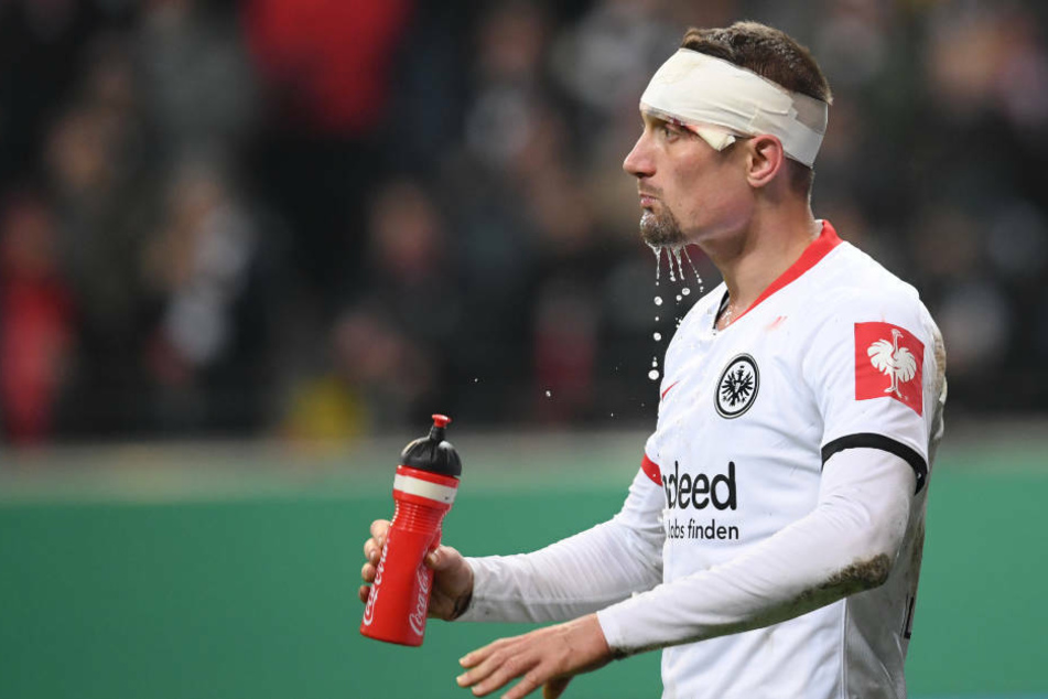 Stefan Ilsanker sah nach dem Pokal-Fight gegen Werder Bremen schwer angeschlagen aus.