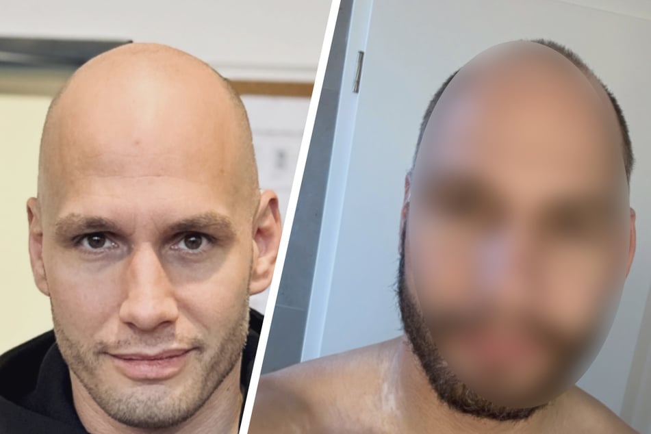 Flying Uwe muss Challenge abbrechen: So krass hat er sich verändert