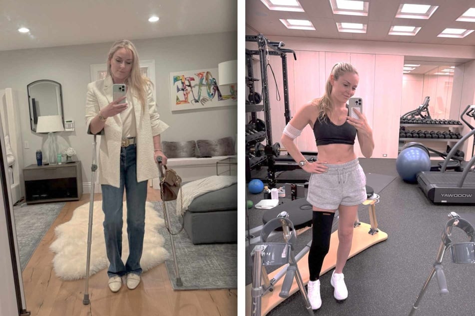 Auf Instagram hält Lindsey Vonn (41) ihre 3,6 Millionen Follower über ihren Genesungsprozess auf dem Laufenden.
