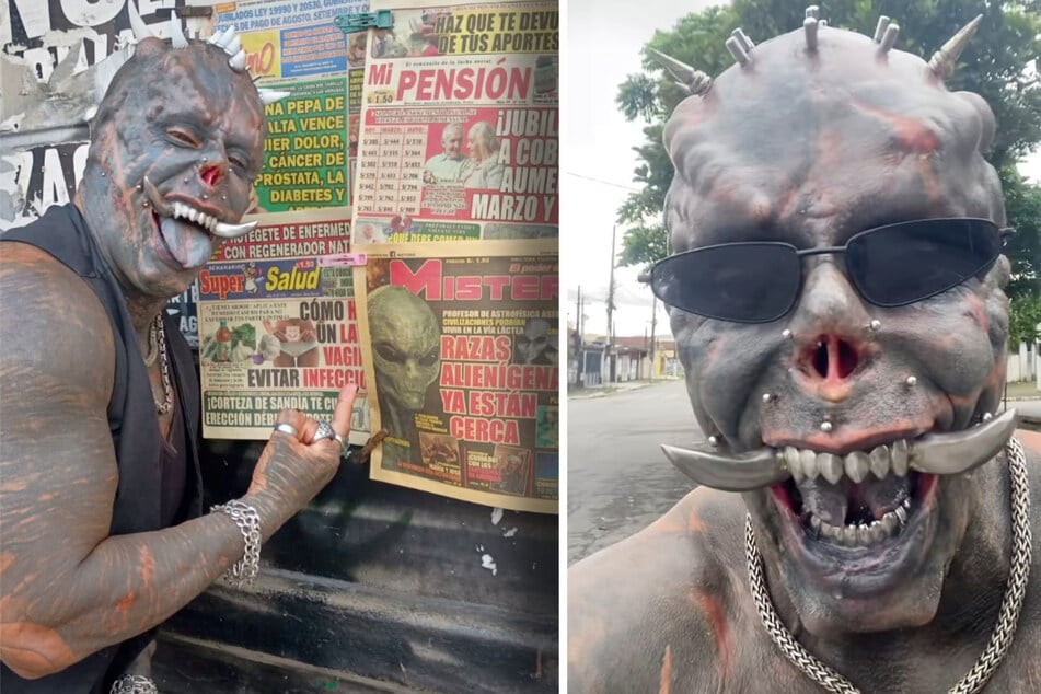 Extreme body modification: "Human Satan" has no ears, now he's having his  fingers amputated | TAG24