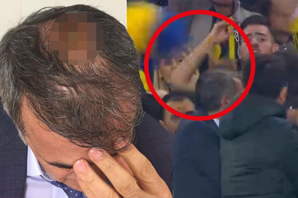 Der Moment, in dem Senol Günes von dem geworfenen Gegenstand getroffen wird.