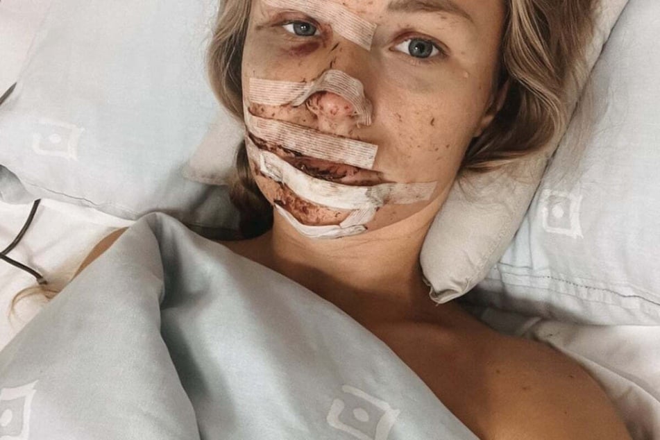 Bei der damals 26-Jährigen bestand nur wenig Hoffnung auf Rettung.