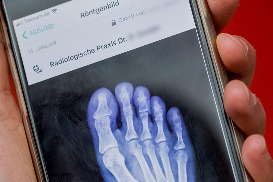 Ein Handyschirm zeigt ein Röntgenbild eine Fußes, aufgenommen bei der Vorstellung der neuen digitalen Gesundheitsakte "Vivy".