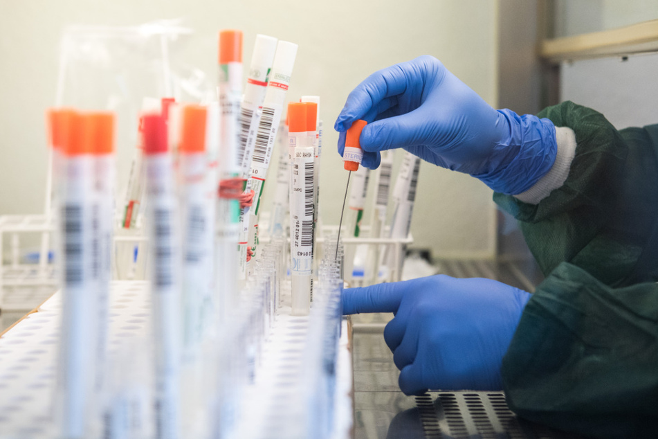 Eine Mitarbeiterin eines Labors in Geesthacht überführt einen trockenen Abstrich eines molekularbiologischen Tests auf das SARS-CoV-2-Virus in eine Flüssigkeit.