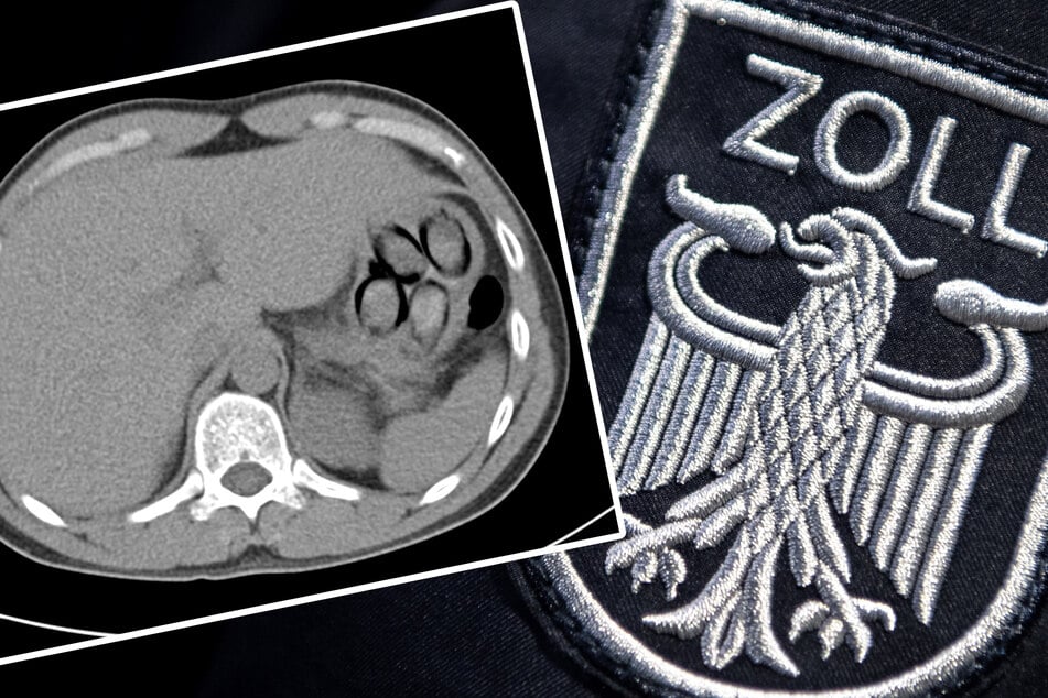 Köln: Mit Kokain im Bauch auf Reisen: Zoll schnappt Körperschmuggler