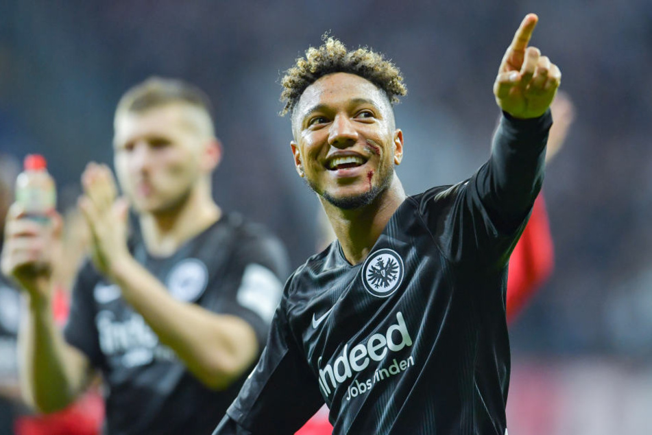 Trotz blutigem Cut im Gesicht konnte man Jonathan de Guzmán die Freude über den Sieg gegen Schalke nicht nehmen.