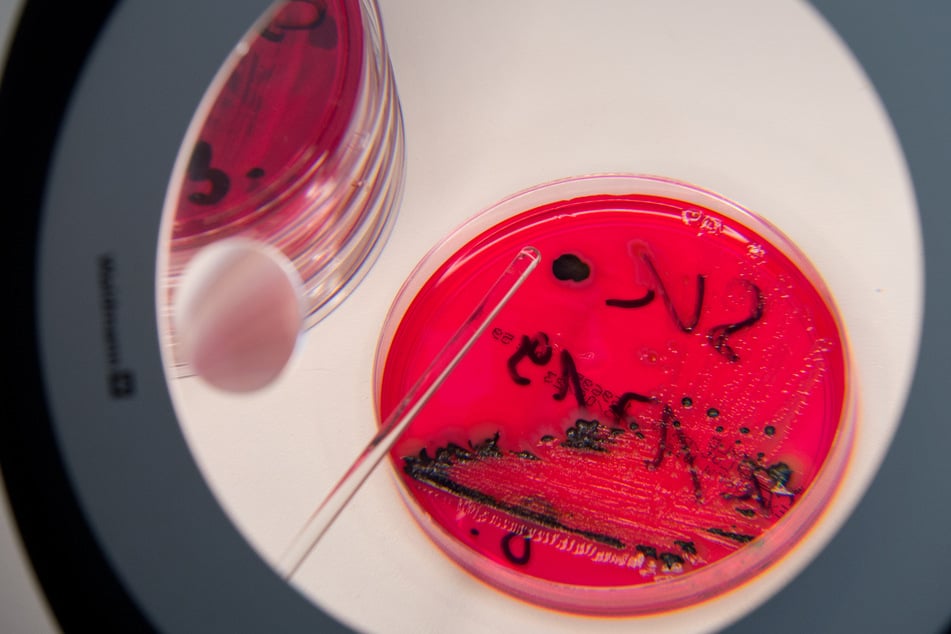 Hundefutter zurückgerufen: Gefahr für Mensch und Tier!