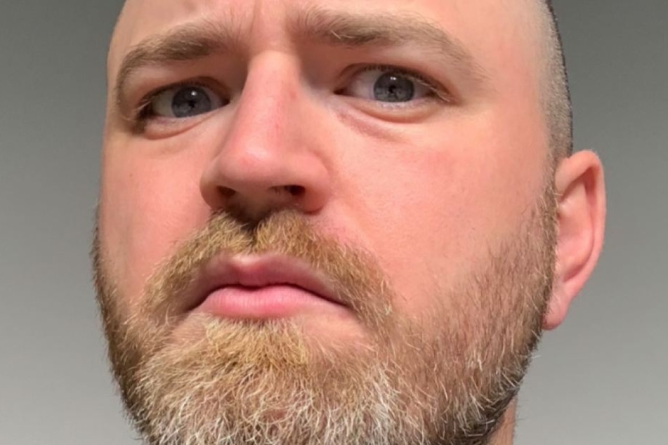 Extrem glatte Haut, keine Rötungen zu erkennen: Lewis fühlt sich, als habe er vor dem Selfie Make-up aufgetragen.
