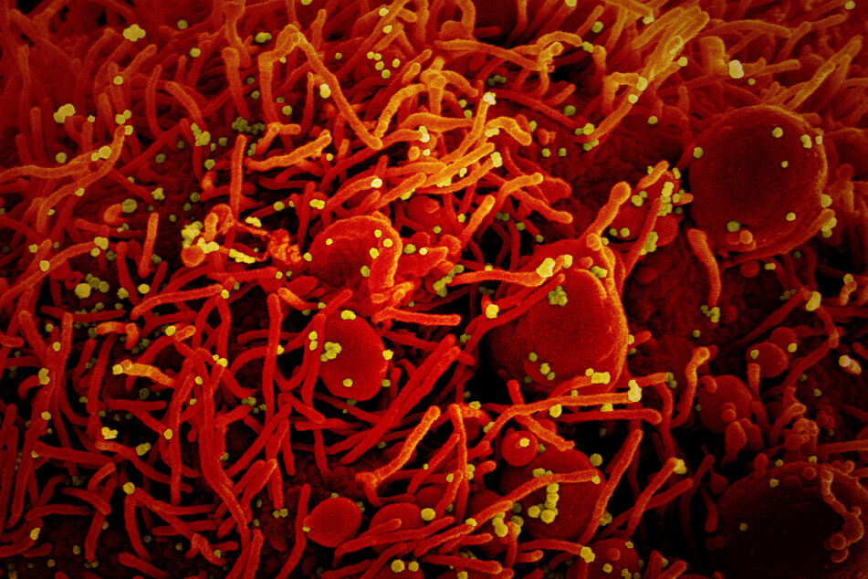 Auf dieser vom US-Forschungszentrum "National Institute of Allergy and Infectious Diseases" (NIAID) zur Verfügung gestellten Aufnahme vom 13.02.2020 ist eine Zelle (rot) mit dem Coronavirus (SARS-CoV-2, gelb) infiziert.
