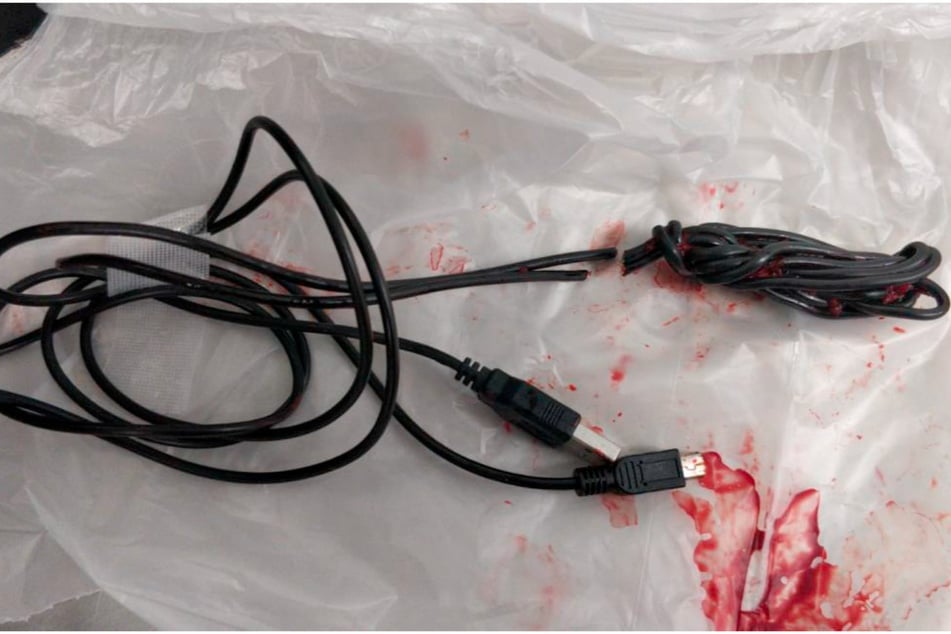 Durch eine OP konnte das USB-Kabel wieder aus dem Körper des Jungen entfernt werden.