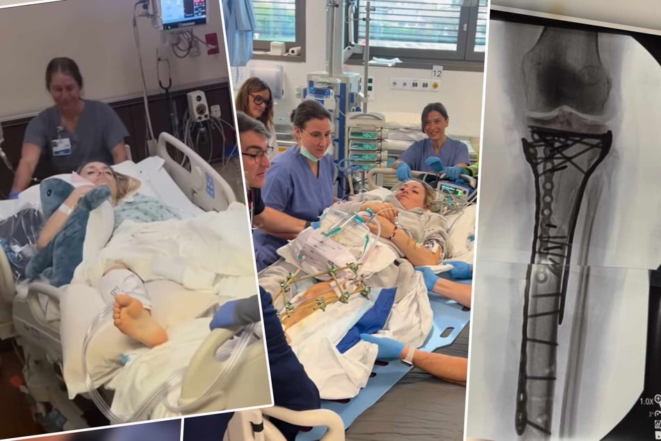 In den sozialen Netzwerken hält Lindsey Vonn (41) über ihren Heilungsprozess auf dem Laufenden.