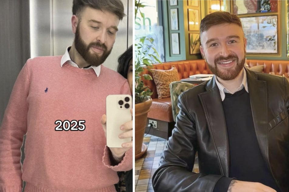 Mittlerweile ist der 25-Jährige alle Filler los und fühlt sich mit seinem "natürlichen" Gesicht deutlich wohler.