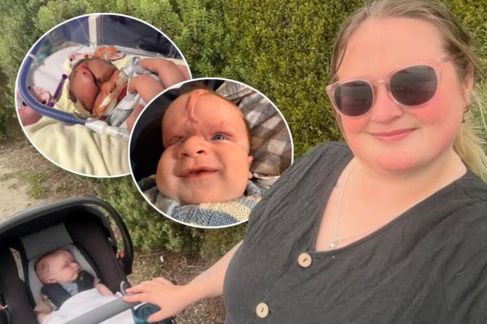 Mutter hat Sorge vor Hass, weil Baby mit seltener Krankheit geboren wird - Es kommt ganz anders!